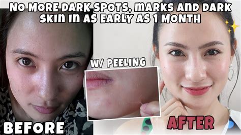 pampakinis ng mukha at pampaputi|PAMPAPUTI at PAMPAKINIS ng MUKHA Result in as easly as .